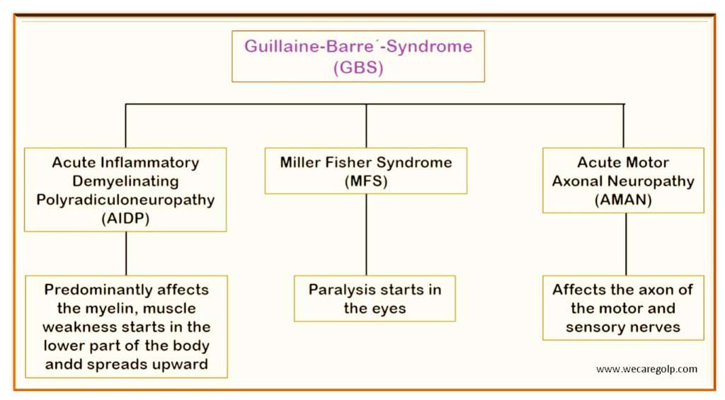 GuillainBarré Syndrome (GBS) We Care