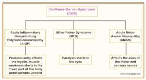 Guillain-Barre´ Syndrome (GBS)