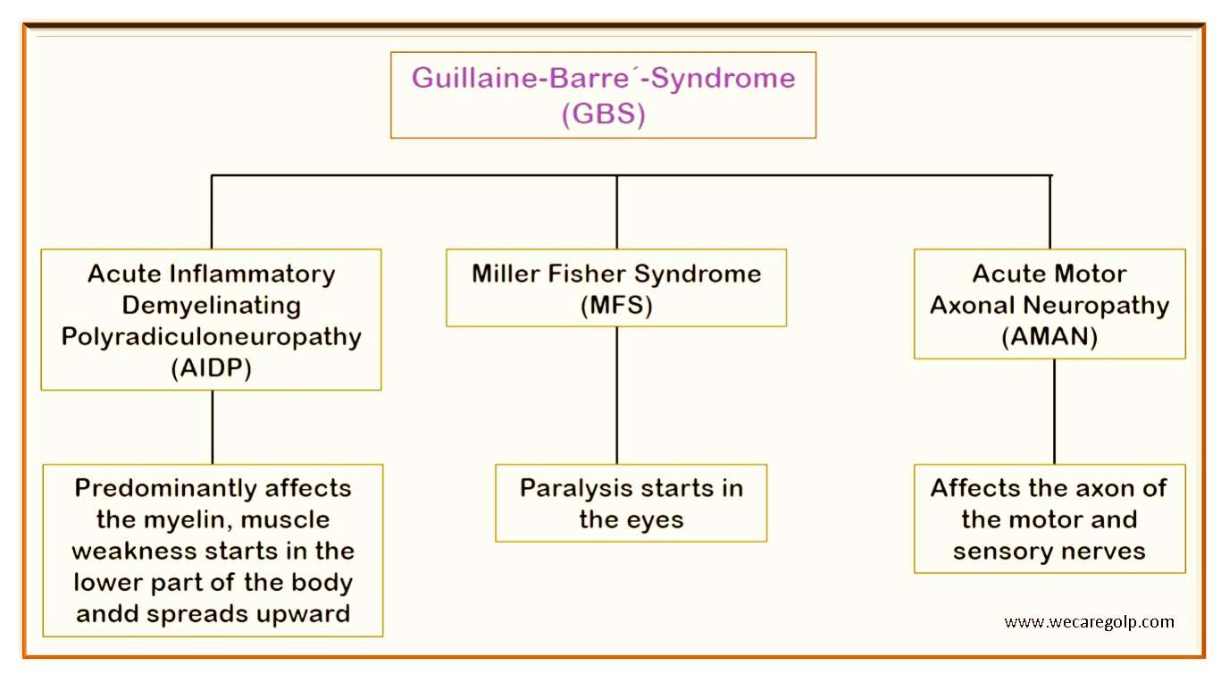 Guillain-Barre´ Syndrome (GBS)