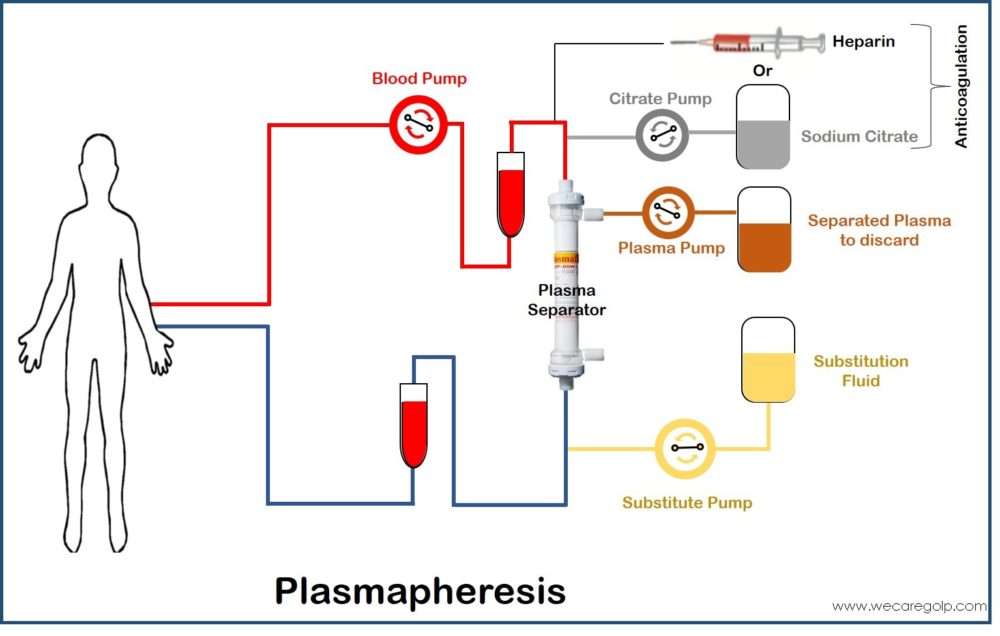 Plasmapheresis We Care