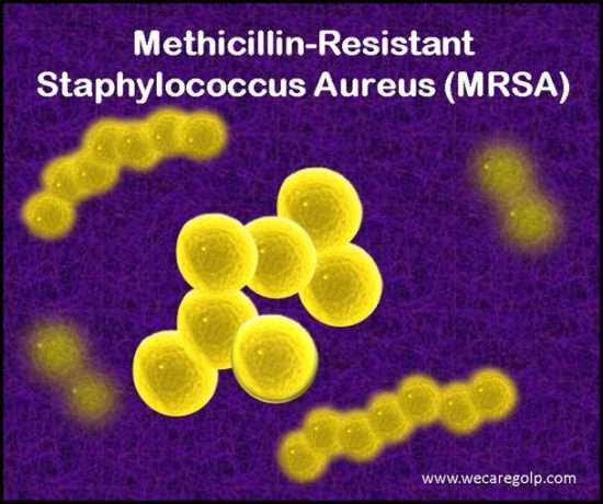 Methicillin-Resistant Staphylococcus Aureus (MRSA)