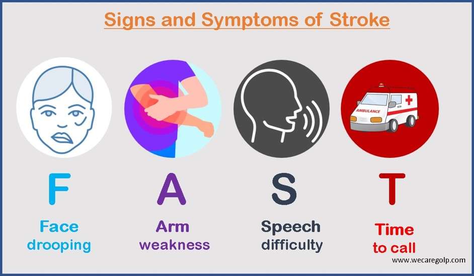 Signs and Symptoms of Stroke