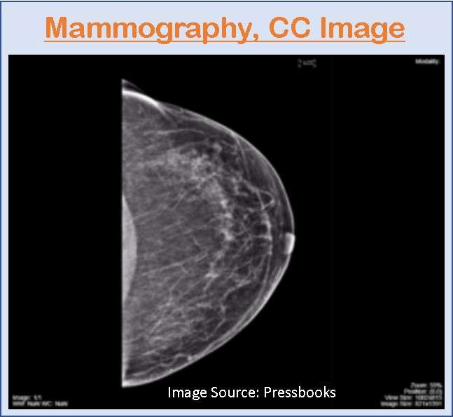 CC Image, Mammography