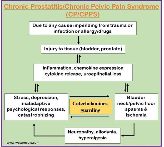 Chronic Prostatitis/Chronic Pelvic Pain Syndrome