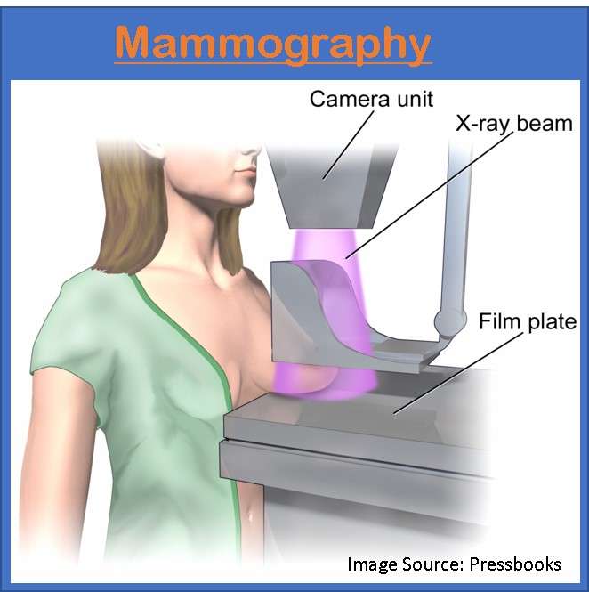 Mammography 