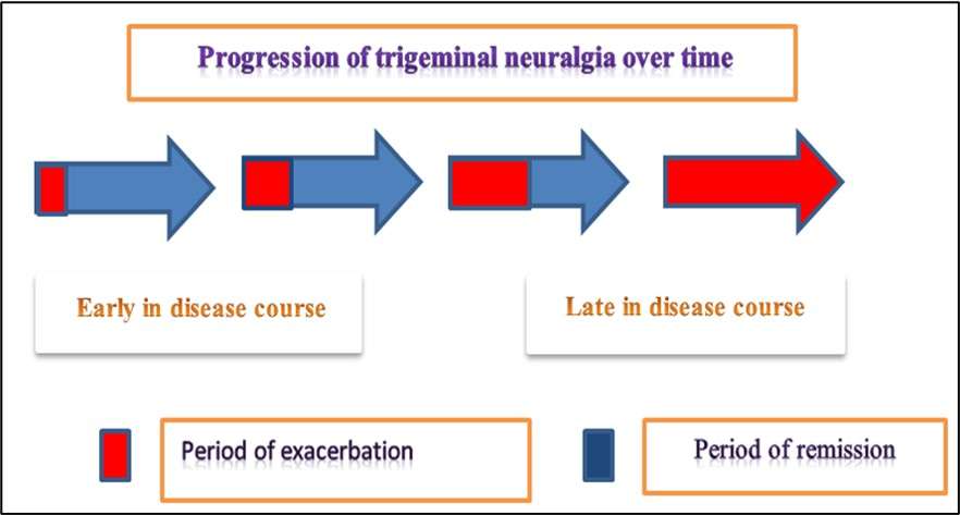 Progression of Trigeminal Neuralgia