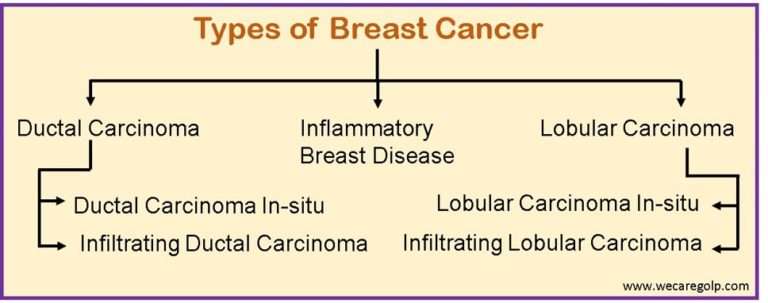 Breast Cancer Types Symptoms Management We Care