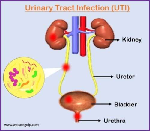 Frontiers  Examination of Complementary Medicine for Treating Urinary  Tract Infections Among Pregnant Women and Children