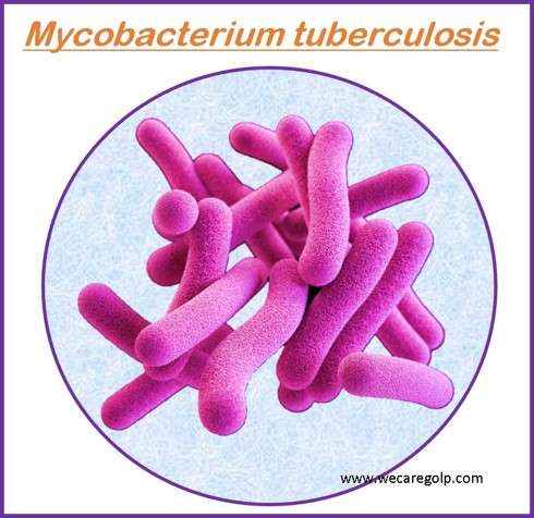 Mycobacterium tuberculosis