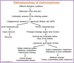 Hydronephrosis (Urinary Tract Dilatation) - We Care