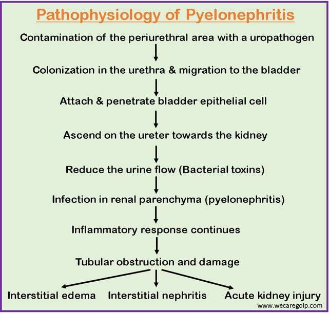 Pathophysiology of Pyelonephritis