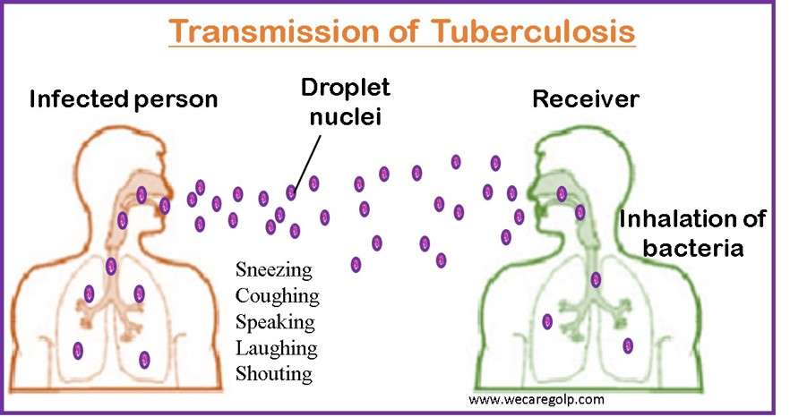 Transmission of Tuberculosis