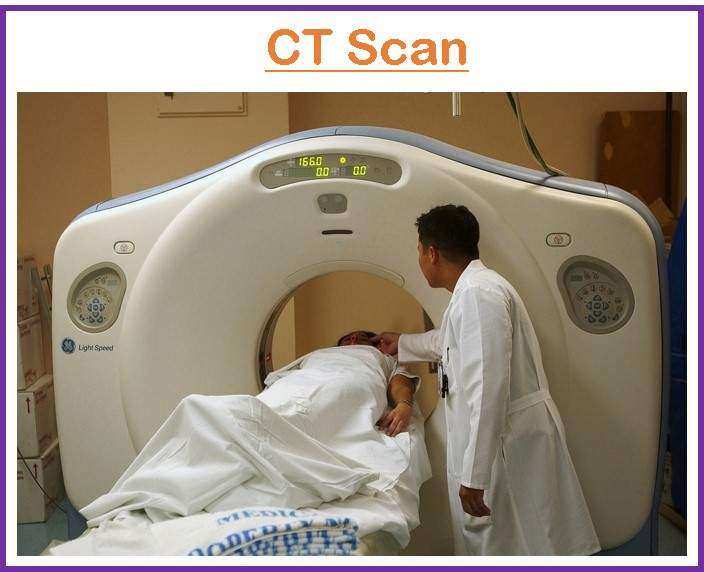 CT (Computed Tomography)Scan