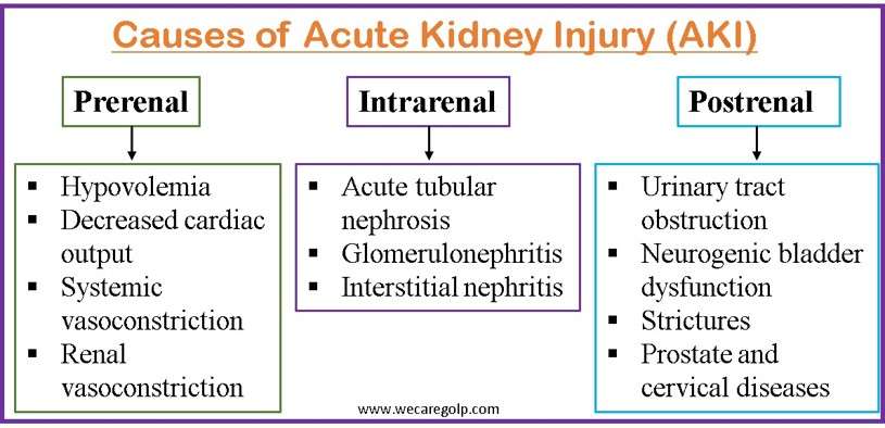 Causes of Acute Kidney Injury (AKI)