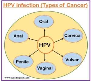 Human Papillomavirus Infection - We Care