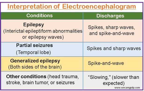 Interpretation of Electroencephalogram