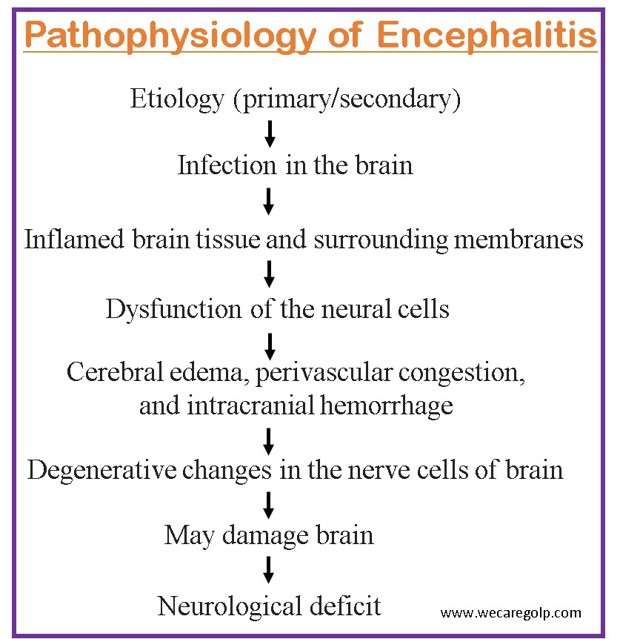 Pathophysiology of Encephalitis