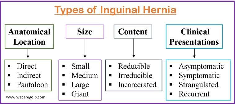 Types of Inguinal Hernia
