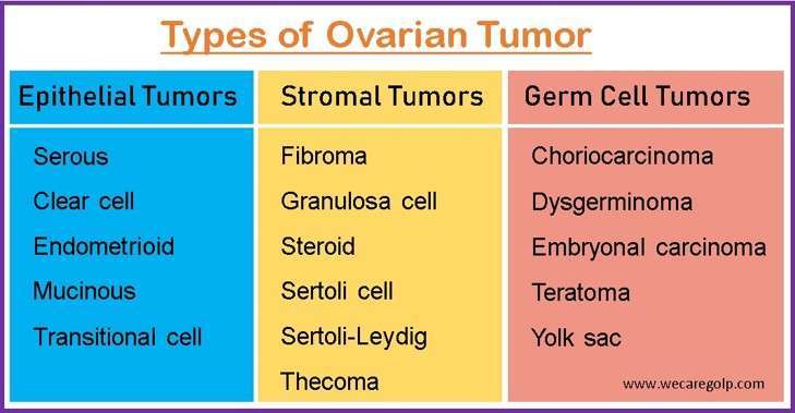 Types of Ovarian Tumor