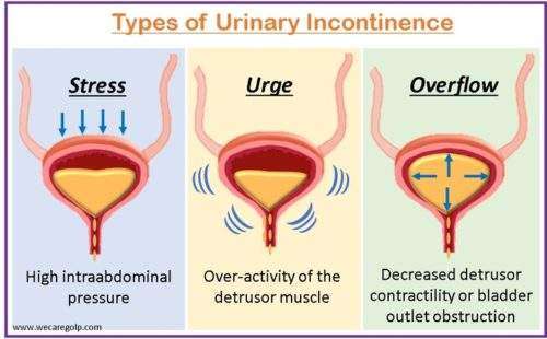 What's the Difference Between Stress Incontinence and Urge