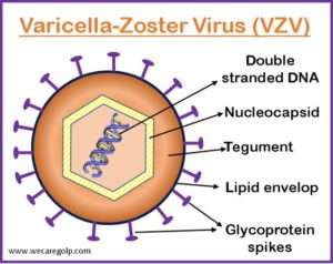 Chickenpox (Varicella-Zoster) - We Care