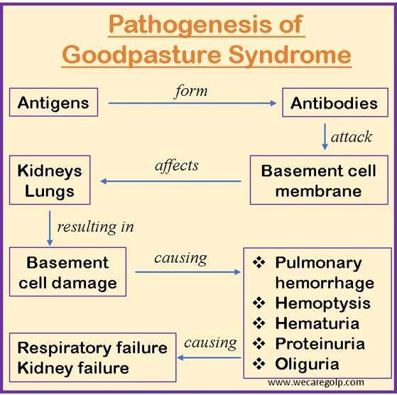 Pathophysiology of Goodpasture Syndrome