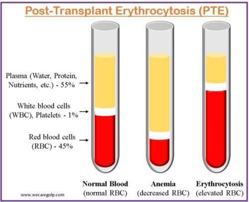 Post-Transplant Erythrocytosis (PTE)
