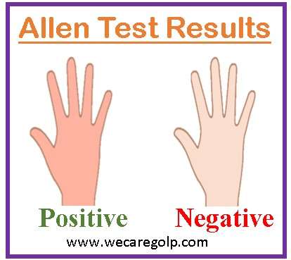 Allen Test Results