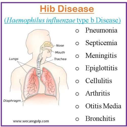 Hib Disease