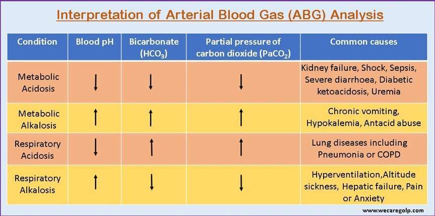 Interpretation of Arterial Blood Gas Analysis