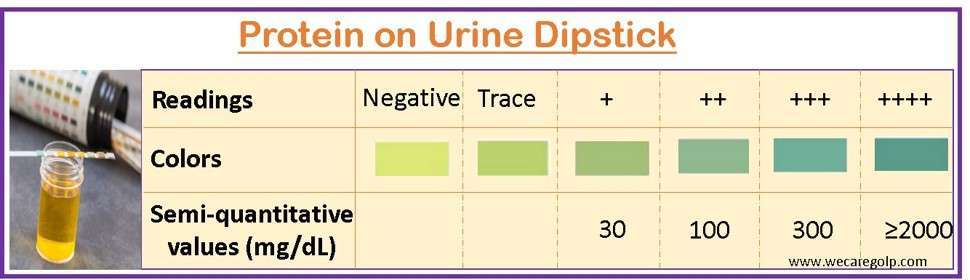 Protein on Urine Dipstick
