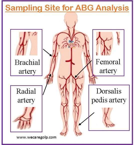 Sampling Site for Arterial Blood Gas (ABG) Analysis