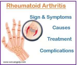 Rheumatoid Arthritis (ra): Sign & Symptoms, Treatment - We Care