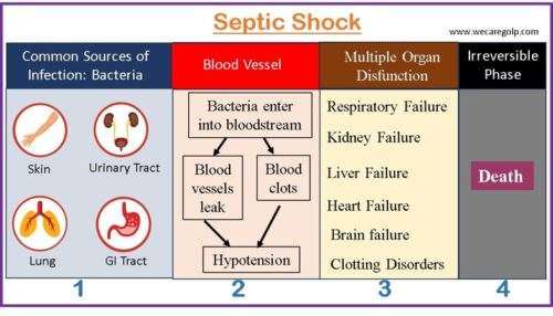 What Are the Three Stages of Sepsis?