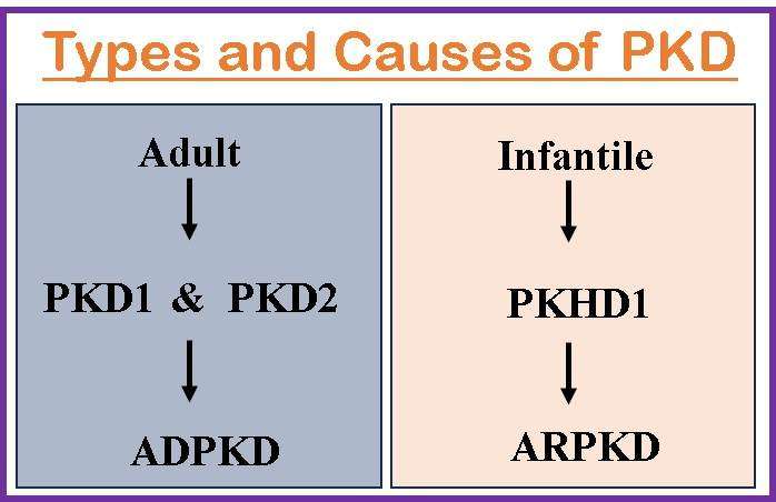 Types and Causes of PKD